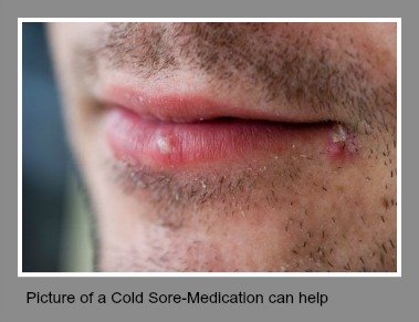 valtrex medicine for cold sores