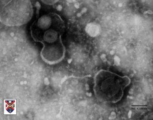 herpes virus under the microscope